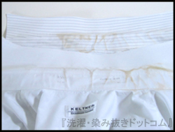 皮脂汚れ