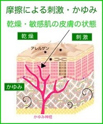 摩擦によるお肌の刺激・かゆみ、そして乾燥肌と敏感肌の状態について